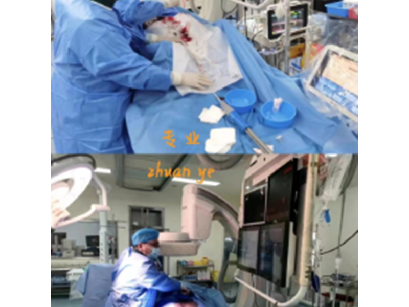 下腔靜脈傘形濾器置入術(shù)